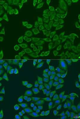 Immunocytochemistry/ Immunofluorescence: RPL36 Antibody - BSA Free [NBP2-94161]