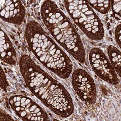 Immunohistochemistry-Paraffin: RPL36 Antibody [NBP2-13255]