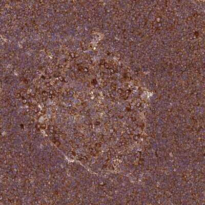 Immunohistochemistry-Paraffin: RPL36 Antibody [NBP2-13255]