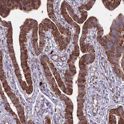 Immunohistochemistry-Paraffin: RPL36 Antibody [NBP2-13255]