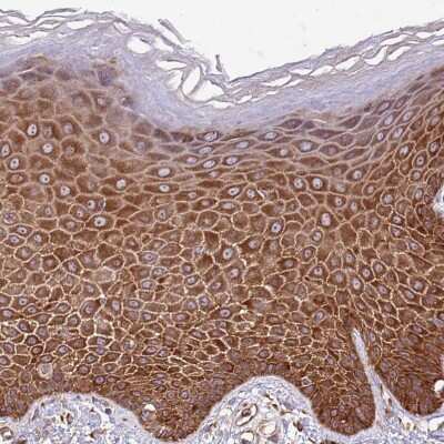 Immunohistochemistry-Paraffin: RPL36 Antibody [NBP2-13255]