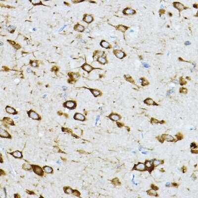 Immunohistochemistry-Paraffin: RPL36 Antibody - BSA Free [NBP2-94161]