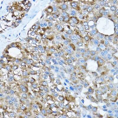 Immunohistochemistry-Paraffin: RPL36 Antibody - BSA Free [NBP2-94161]