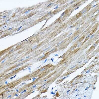Immunohistochemistry-Paraffin: RPL36 Antibody - BSA Free [NBP2-94161]