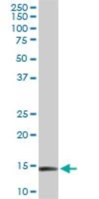 Western Blot: RPL36A Antibody (5F8) [H00006173-M01]