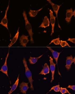 Immunocytochemistry/ Immunofluorescence: RPL36AL Antibody - Azide and BSA Free [NBP2-93339]