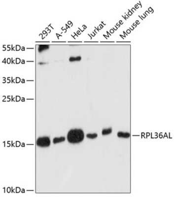 Western Blot: RPL36AL AntibodyAzide and BSA Free [NBP2-93339]