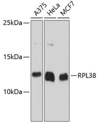 Western Blot: RPL38 AntibodyAzide and BSA Free [NBP2-93762]