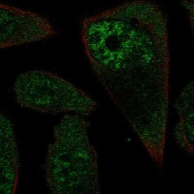 Immunocytochemistry/ Immunofluorescence: RPL3L Antibody [NBP2-13257]