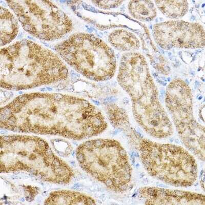 Immunohistochemistry-Paraffin: RPL4 Antibody - BSA Free [NBP2-94398]