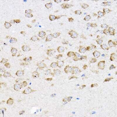 Immunohistochemistry-Paraffin: RPL4 Antibody - BSA Free [NBP2-94398]