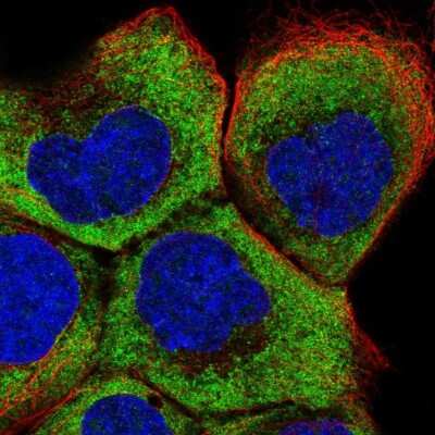 Immunocytochemistry/ Immunofluorescence: RPL5 Antibody [NBP2-68710]