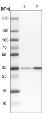 Western Blot: RPL5 Antibody [NBP1-92347]