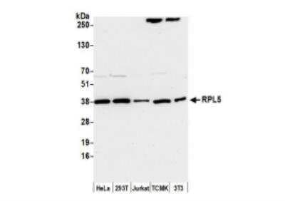 Western Blot: RPL5 Antibody [NBP2-22285]