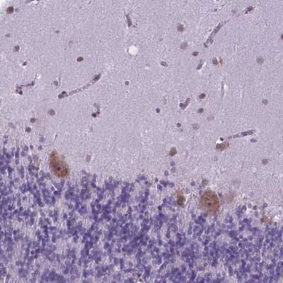 Immunohistochemistry: RPL6 Antibody [NBP2-49552]