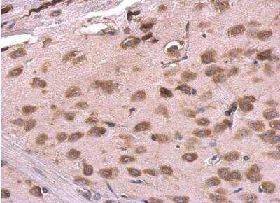 Immunohistochemistry-Paraffin: RPL6 Antibody [NBP2-20216]