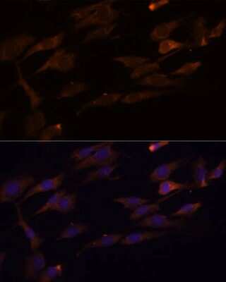 Immunocytochemistry/ Immunofluorescence: RPL7A Antibody - Azide and BSA Free [NBP2-93830]