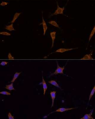 Immunocytochemistry/ Immunofluorescence: RPL7A Antibody - Azide and BSA Free [NBP2-93830]