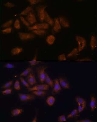 Immunocytochemistry/ Immunofluorescence: RPL7A Antibody - Azide and BSA Free [NBP2-93830]