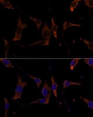Immunocytochemistry/ Immunofluorescence: RPL7A Antibody - Azide and BSA Free [NBP2-94629]