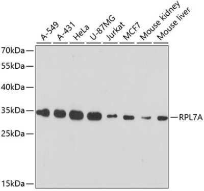 Western Blot: RPL7A AntibodyAzide and BSA Free [NBP2-94629]