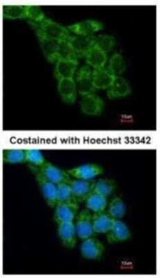 Immunocytochemistry/ Immunofluorescence: RPL8 Antibody [NBP1-33294]
