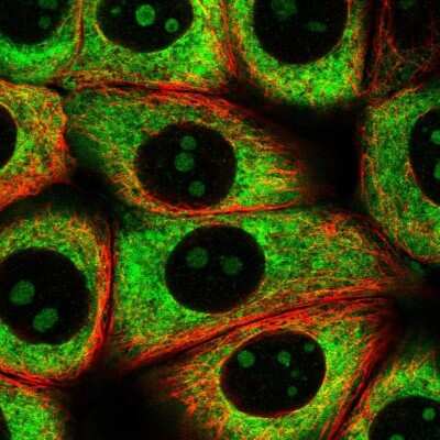 Immunocytochemistry/ Immunofluorescence: RPL8 Antibody [NBP2-47297]