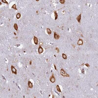 Immunohistochemistry: RPL8 Antibody [NBP2-48827]