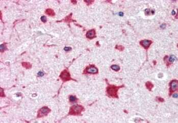 Immunohistochemistry-Paraffin: RPL8 Antibody [NB100-68143]