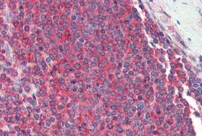 Immunohistochemistry-Paraffin: RPL8 Antibody [NB100-68143]