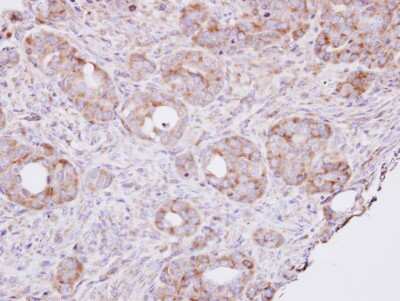 Immunohistochemistry-Paraffin: RPL8 Antibody [NBP1-33294]