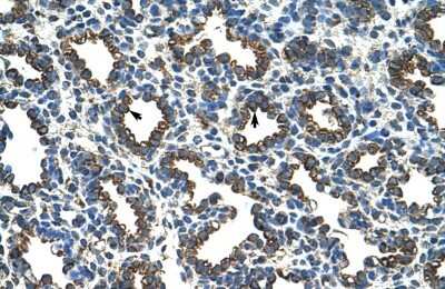 Immunohistochemistry-Paraffin: RPL8 Antibody [NBP1-57479]