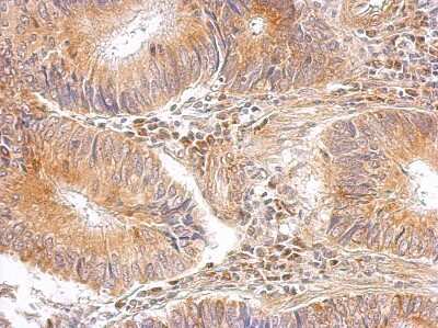 Immunohistochemistry-Paraffin: RPL8 Antibody [NBP2-20218]
