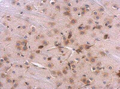 Immunohistochemistry-Paraffin: RPL8 Antibody [NBP2-20218]