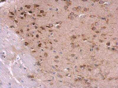 Immunohistochemistry-Paraffin: RPL8 Antibody [NBP2-20218]