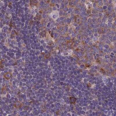 Immunohistochemistry-Paraffin: RPL8 Antibody [NBP2-47297]