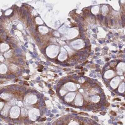 Immunohistochemistry-Paraffin: RPL8 Antibody [NBP2-47297]