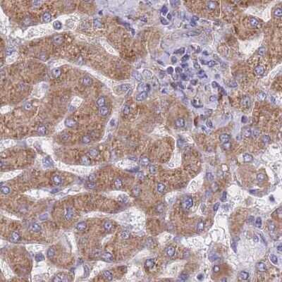 Immunohistochemistry-Paraffin: RPL8 Antibody [NBP2-47297]