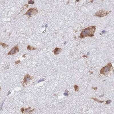 Immunohistochemistry-Paraffin: RPL8 Antibody [NBP2-47297]