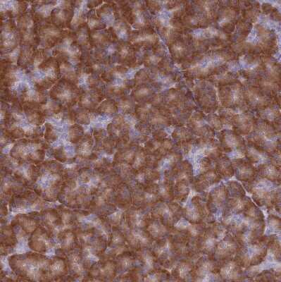 Immunohistochemistry-Paraffin: RPL8 Antibody [NBP2-47297]