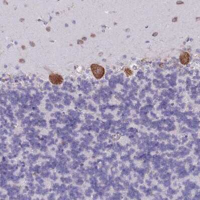 Immunohistochemistry-Paraffin: RPL8 Antibody [NBP2-47297]