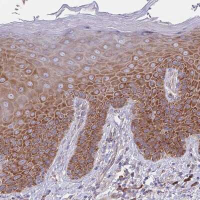 Immunohistochemistry-Paraffin: RPL8 Antibody [NBP2-47297]