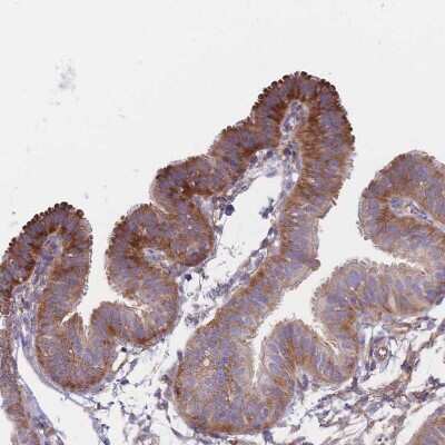 Immunohistochemistry-Paraffin: RPL8 Antibody [NBP2-47297]