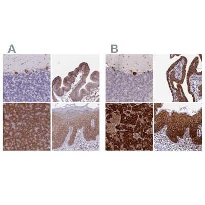 Immunohistochemistry-Paraffin: RPL8 Antibody [NBP2-47297]