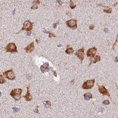 Immunohistochemistry-Paraffin: RPL8 Antibody [NBP2-48827]