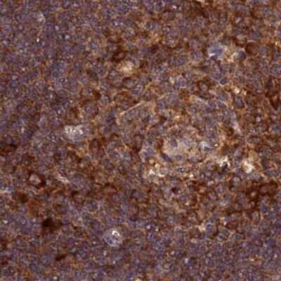 Immunohistochemistry-Paraffin: RPL8 Antibody [NBP2-48827]