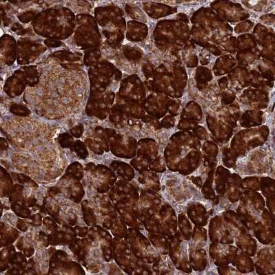 Immunohistochemistry-Paraffin: RPL8 Antibody [NBP2-48827]