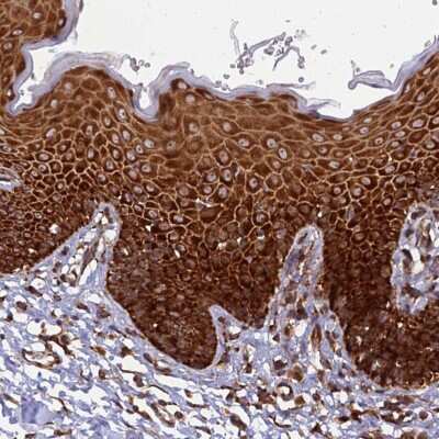 Immunohistochemistry-Paraffin: RPL8 Antibody [NBP2-48827]