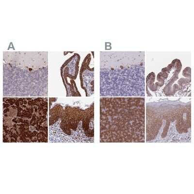 Immunohistochemistry-Paraffin: RPL8 Antibody [NBP2-48827]