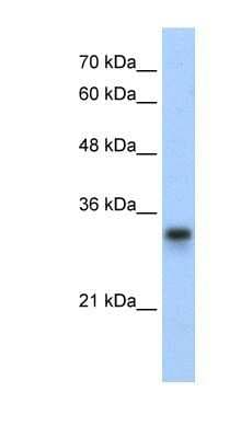 Western Blot: RPL8 Antibody [NBP1-57479]